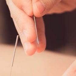 Treatment by Tenna